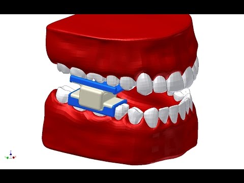 Стоматологическая фрезерная машинка