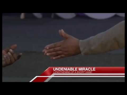 Undeniable Miracle